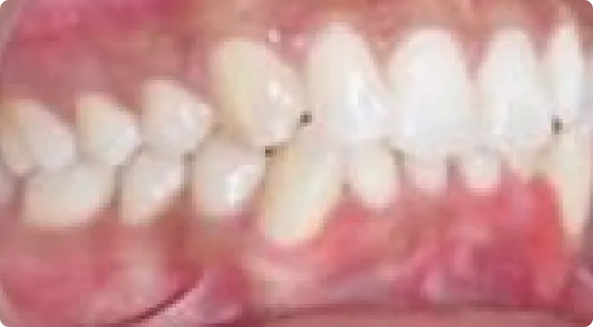 orthodontic