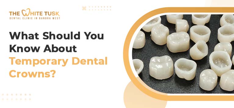 What Should You Know About Temporary Dental Crowns?