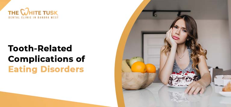 Tooth-Related Complications of Eating Disorders