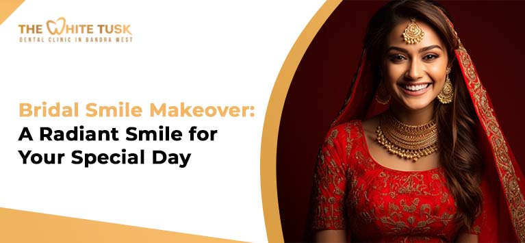 Bridal Smile Makeover: A Radiant Smile for Your Special Day