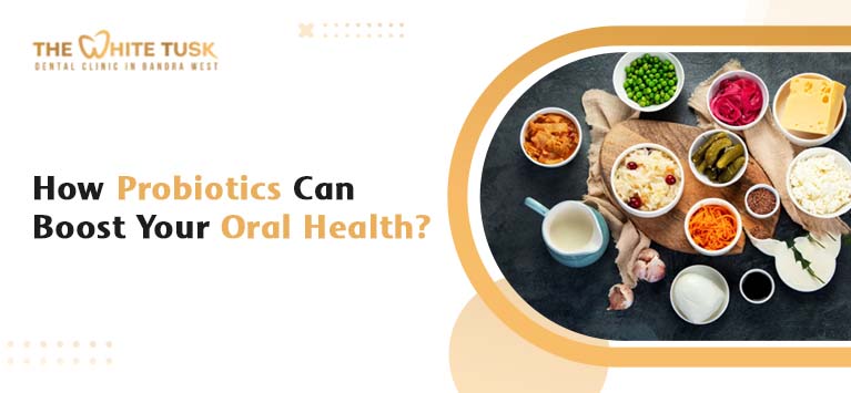 How Probiotics Can Boost Your Oral Health?