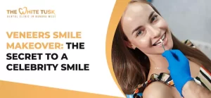 Veneers -Smile -Makeover-:- The -Secret -to- a -Celebrity- Smile