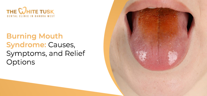 Burning Mouth Syndrome: Causes, Symptoms, and Relief Options