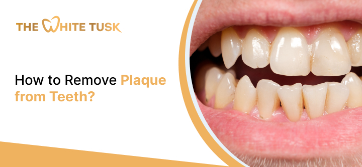 How to Remove Plaque from Teeth?